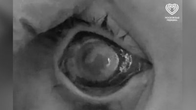 Столичные врачи спасли зрение двум мальчикам после опасного интернет-эксперимента